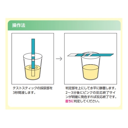 ヒト絨毛性性腺刺激ホルモンキット Gチェ