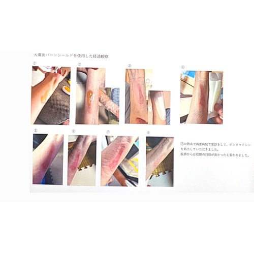 冷却用ドレッシングBS 100×100m