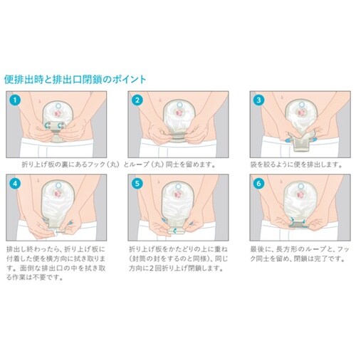 センシュラ ミオ1 消化管ストーマ用 単