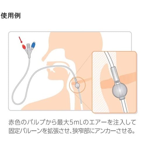 食道拡張用バルーンカテーテル 14Fr