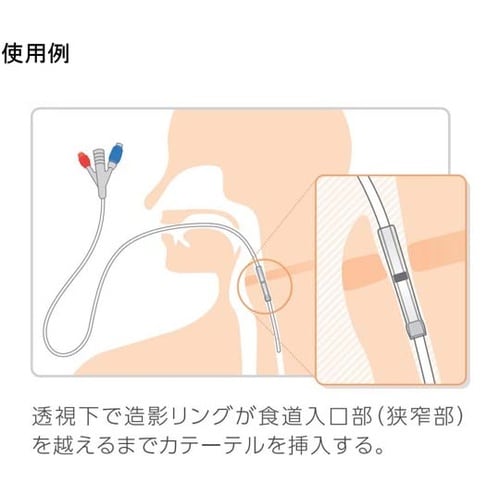 食道拡張用バルーンカテーテル 16Fr