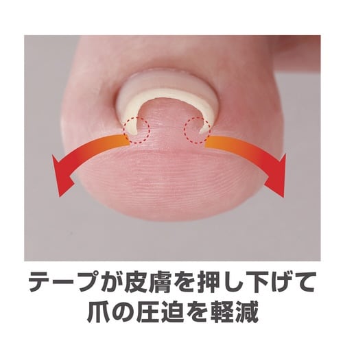 透明巻き爪テープ ミエーヌ 1袋(10枚入)