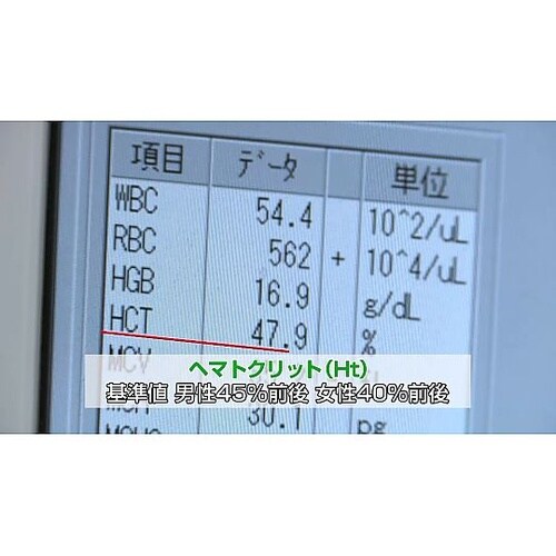 人体の構造と機能 第6巻 血液 DV40