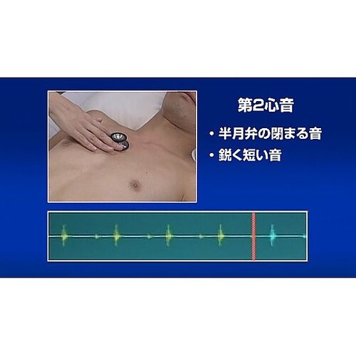 人体の構造と機能 第7巻 循環系(1)