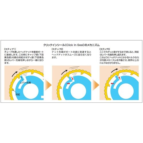 インバーテッドコーンフィッティングシステ