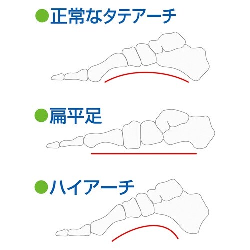 タテアーチサポーター 薄型 63296
