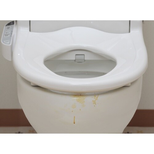 トイレパット 汚れ防止 14個入