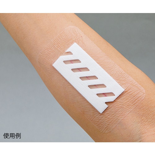 サージフィット(TM)(手術用被覆・保護材)