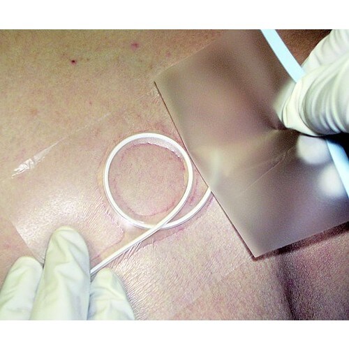 サージンフィルム10ミクロン 50×70mm