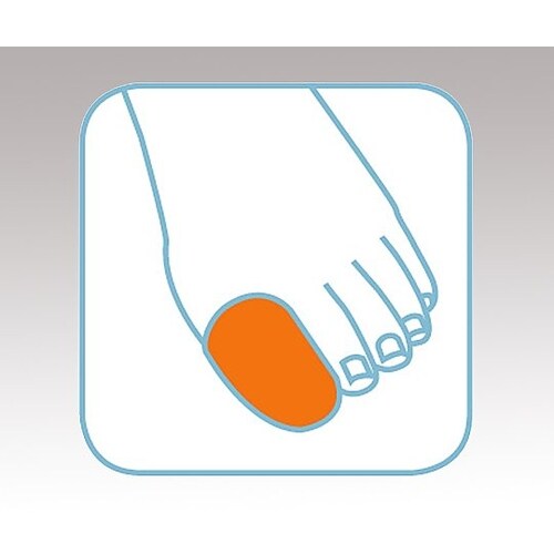 セラステップ ゲルトゥキャップ (小) 1個入