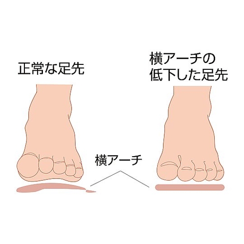 RA[`T|[^[@^