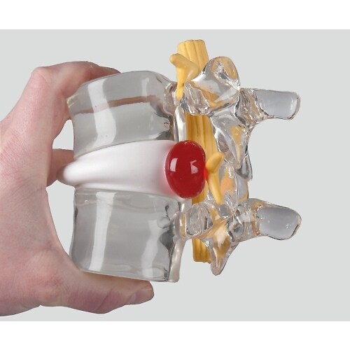 ヘルニアモデル 190×160×140