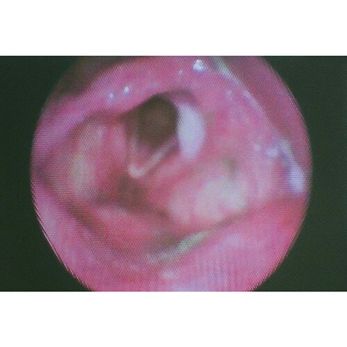 嚥下治療講座 2018山形読影会DVD