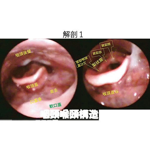 嚥下治療講座 2018山形読影会DVD