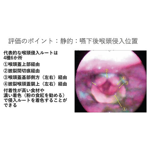 嚥下治療講座 2018山形読影会DVD