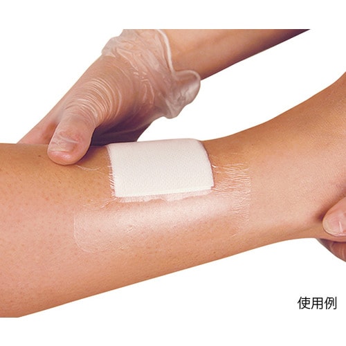 メピテルフィルム 296200