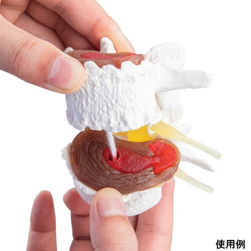 椎間板変性症モデル 7577