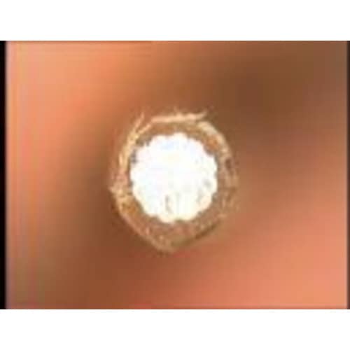 PTTE線ストリッピングセット