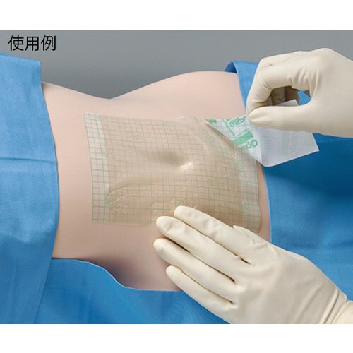 医≫4632 オプサイト ウンド