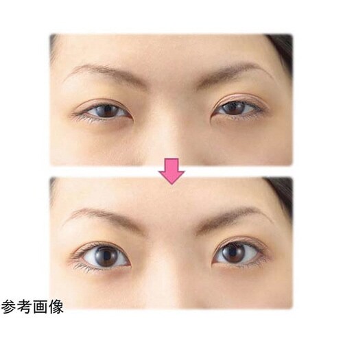 眼輪筋エクササイズ アイストレッチ