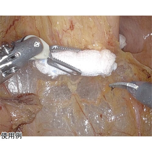 トロックスR ロールタイプ 滅菌済 10