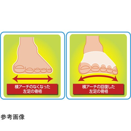 横アーチにアプローチ さわやか足楽サポー