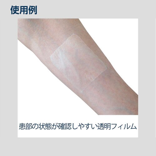 ナビス フィルムドレッシング SD060