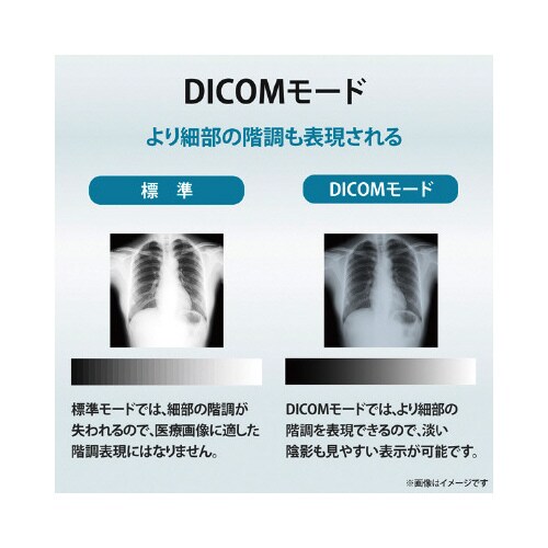 27型ワイドディスプレイ 3.6MP医用画像参照