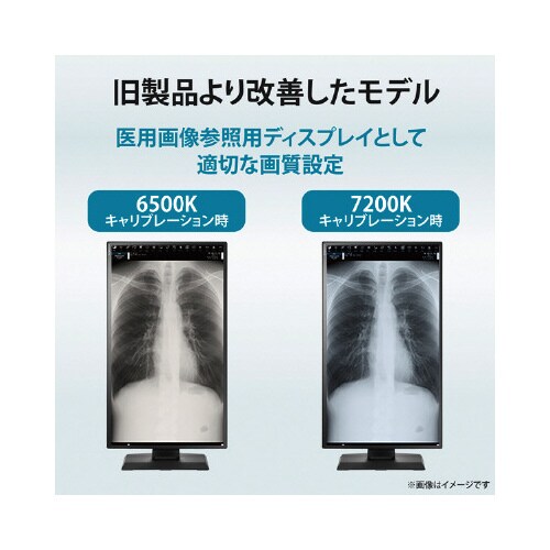 27型ワイドディスプレイ 3.6MP医用画像参照