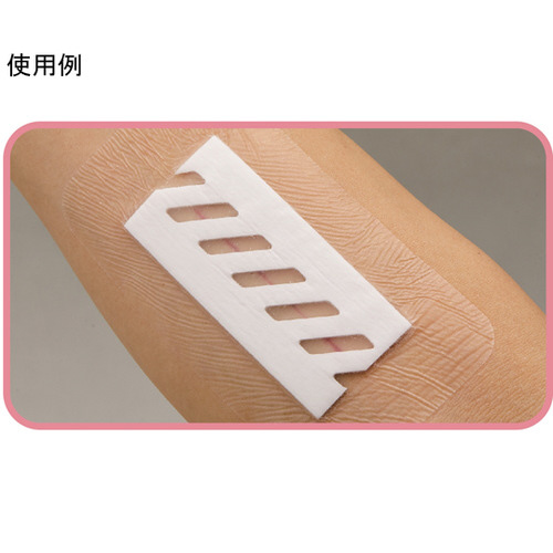サージフィット™（手術用被覆・保護材） EOG滅菌済 SRGシリーズ