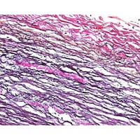 �P�D�O�O�P�X�X�D�O�T�O�O�@�s�N���t�N�V��