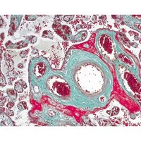 �P�D�O�O�S�W�T�D�O�O�O�P�@�}�b�\���|�S�[