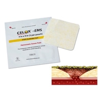 �Z���b�N�X�@�d�l�r�@�~���K�[�[�@�W�~�W�@�P�܁i�S�����j�@�`�P�R�l�s�O�O�R