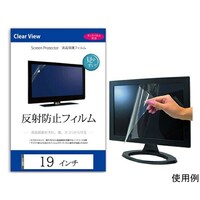 �t���ی�t�B�����@���˖h�~�@�P�X�C���`�@���������|�������|�P�X