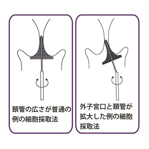 �זE�̎���