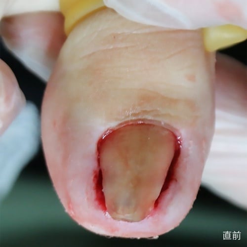 �܂��Â߃��C���[�^�@�܂��Â߃��t�g�X�^�[�^�[�Z�b�g