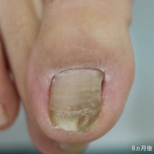 �܂��Â߃��C���[�^�@�܂��Â߃��t�g�X�^�[�^�[�Z�b�g