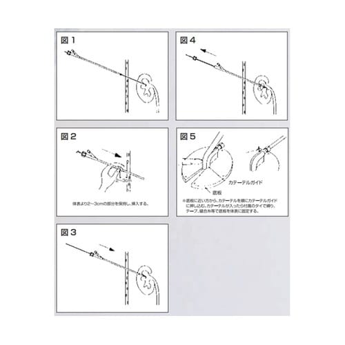 ネフロストミーキット 340mm 腎盂バルーン型