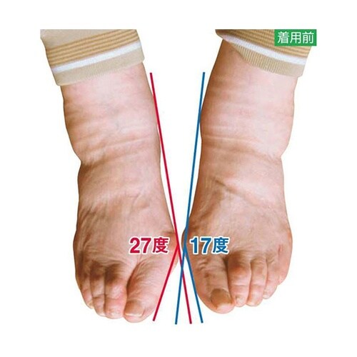 外反母趾対策靴下