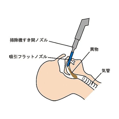 ztbgmY
